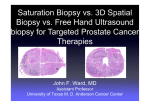 Transrectal 12-Core Biopsy is superior to Saturation biopsy for