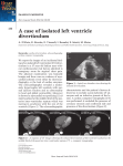 A case of isolated left ventricle diverticulum