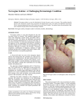 Norwegian Scabies: A Challenging Dermatologic Condition