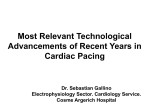 Most relevant technological advancements in cardiac pacing