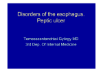 Diseases of the esophagus. Peptic ulcer