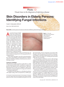 Skin Disorders in Elderly Persons: Identifying Fungal Infections