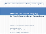 3D Echo and Fusion imaging To Guide Transcatheter Procedures