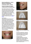 Resolving Moderate – Severe Anterior Crowding with Orthodontic