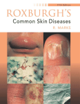 Roxburgh`s Common Skin Diseases