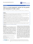 TPX2 is a novel prognostic marker for the growth and metastasis of