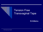 Tension Free Transvaginal Tape and Trans obturator Tape for stress