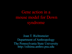 Developmental instability in a mouse model for Down syndrome