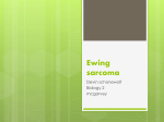 Ewing sarcoma