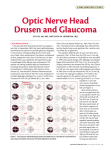 Optic Nerve Head Drusen and Glaucoma