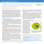 Diagnosing Early Keratoconus