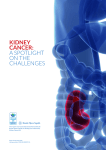 kidney cancer: a spotlight on the challenges