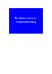 Modified radical mastoidectomy
