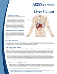 Liver Cancer