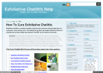 Exfoliative Cheilitis Help