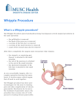 Whipple Procedure - MUSC Digestive Disease Center