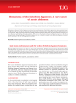 Hematoma of the falciform ligament: A rare cause of acute abdomen