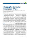 Managing Two Challenging Presentations of Acne