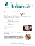 What is Trichomoniasis? Trichomoniasis, often known as Trich, is a
