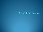 Acne 102: Topics in Acne