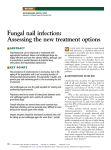 Fungal nail infection: Assessing the new treatment options W ■
