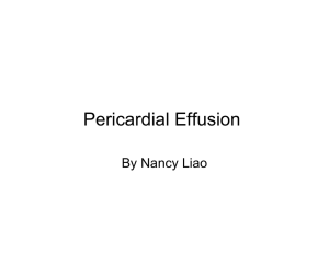 Pericardial Effusion 2