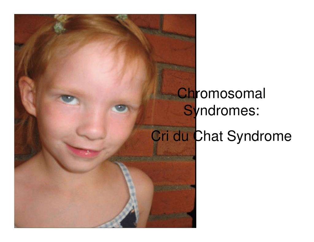 Chromosomal Syndromes Cri Du Chat Syndrome Chromosomal Syndromes Cri Du Chat Syndrome