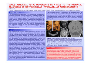 could abnormal fetal movements be a clue to the prenatal diagnosis
