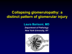 Collapsing glomerulopathy: a distinct pattern of glomerular injury