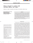 “Cherry red spot” in a patient with Tay-Sachs disease: case report