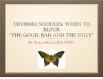 THYROID NODULES: WHEN TO REFER “THE GOOD, BAD AND