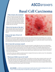 Basal Cell Carcinoma
