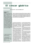 El Cáncer Gástrico Stomach Cancer