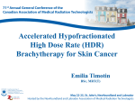 Accelerated Hypofractionated High Dose Rate (HDR) Brachytherapy for Skin Cancer Emilia Timotin