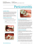 Pericoronitis - Green Dental