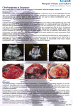 Chorioangioma in Pregnancy - The Fetal Medicine Foundation