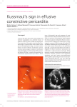 Kussmaul`s sign in effusive constrictive pericarditis