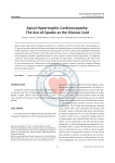 Apical Hypertrophic Cardiomyopathy: The Ace-of