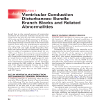 Ventricular Conduction Disturbances: Bundle Branch Blocks and