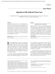 Agenesis of the Inferior Vena Cava