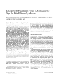 Echogenic Intracardiac Focus: A Sonographic Sign for