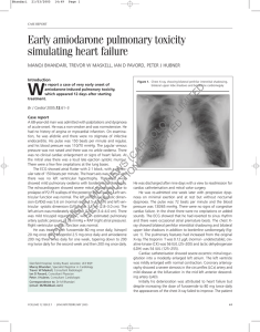 Early amiodarone pulmonary toxicity simulating heart failure