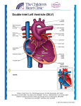 Double Inlet Left Ventricle (DILV)