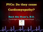 PVCs - Saudi Heart Association