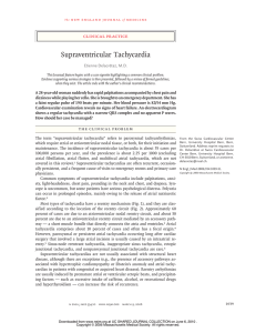Supraventricular Tachycardia - UCSF Department of Anesthesia and