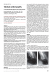 Takotsubo cardiomyopathy