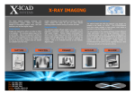 x-ray imaging - X-ICAD