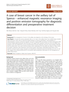 A case of breast cancer in the axillary tail of Spence