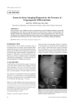 Foetus-in-foetu: Imaging Diagnosis by the Presence of