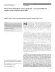 Intracranial arterialized venous angioma: case report with new